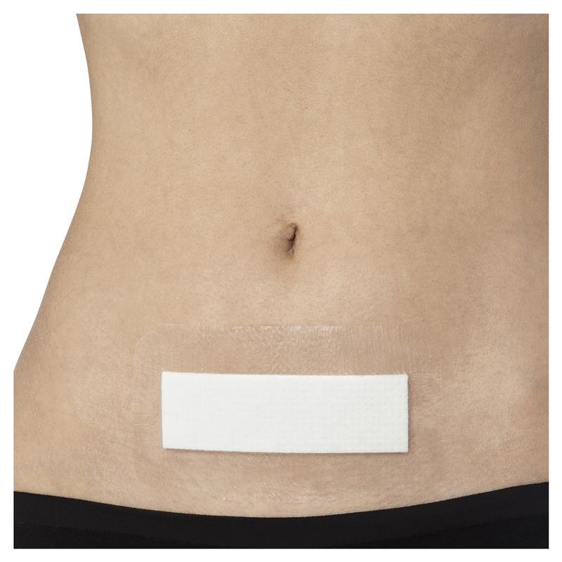 Opsite Post-Op 15cm X 8cm Single Dressing