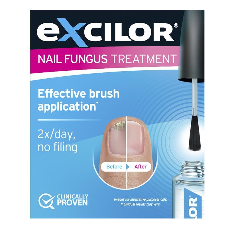 Excilor 甲癣液 3.3ml