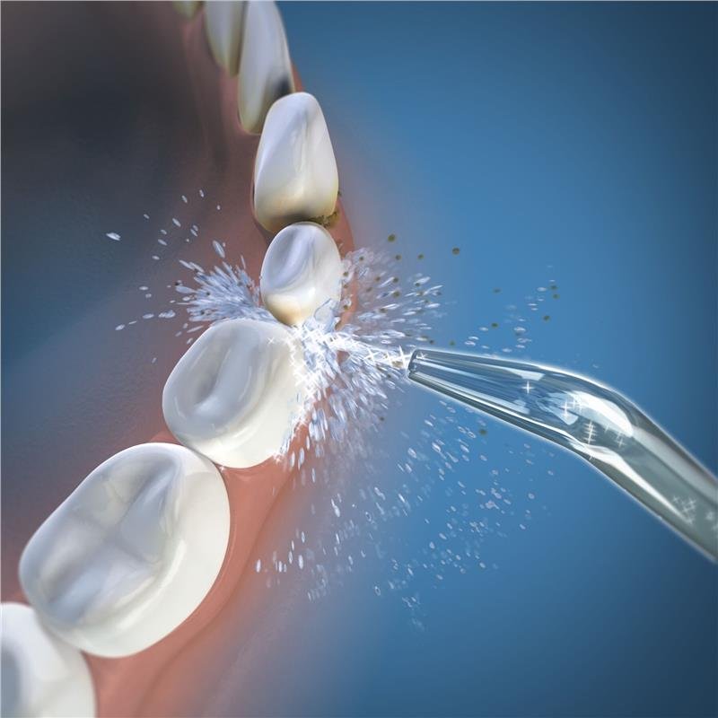 Waterpik 洁碧 经典冲牙器喷头 2个