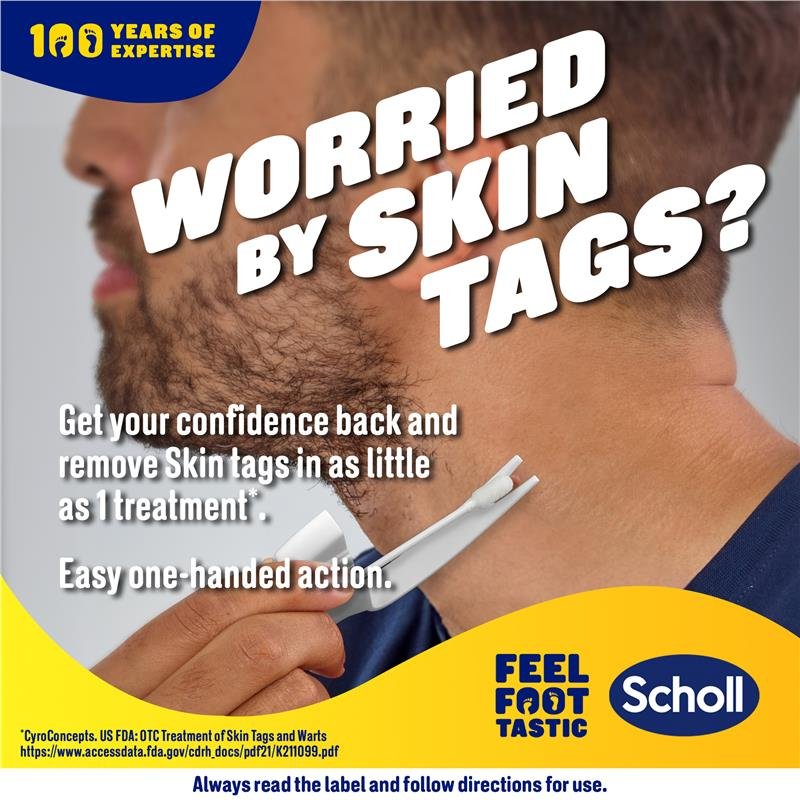 Scholl 爽健 冷冻式皮赘去除器