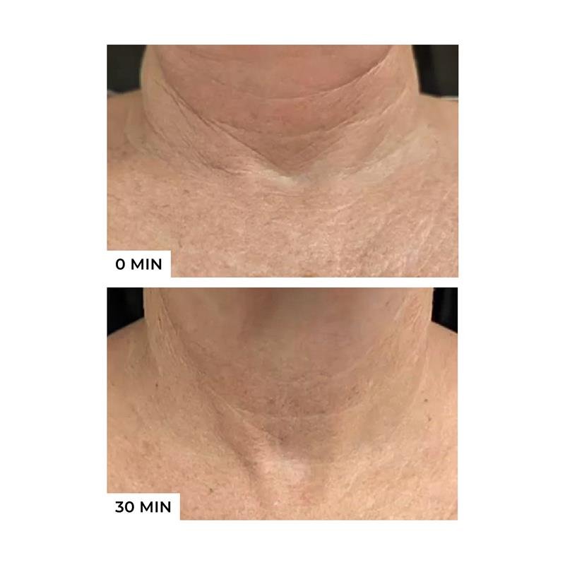 Freezeframe Neck Lift 50ml